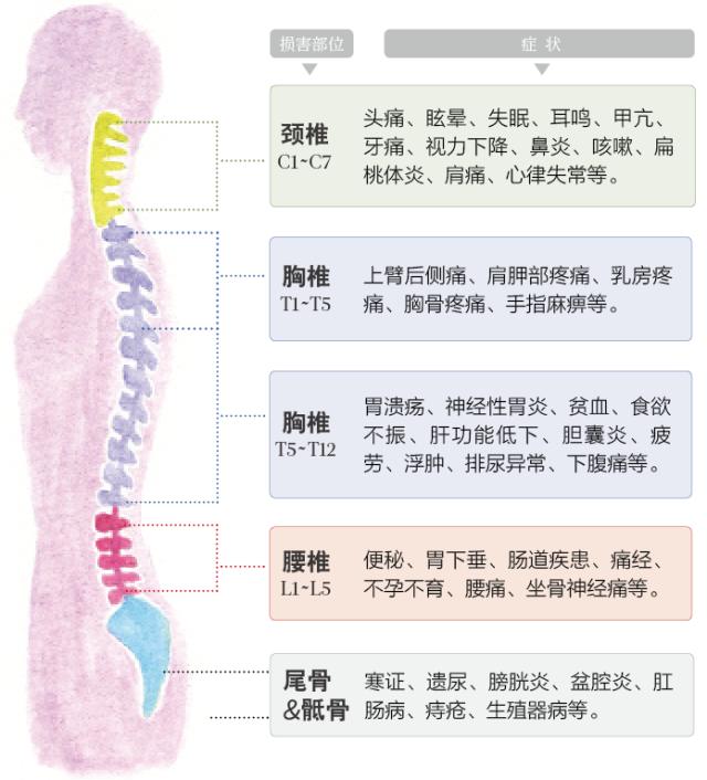 颈椎牵引硬支撑的作用及其在颈椎健康中的重要性解析